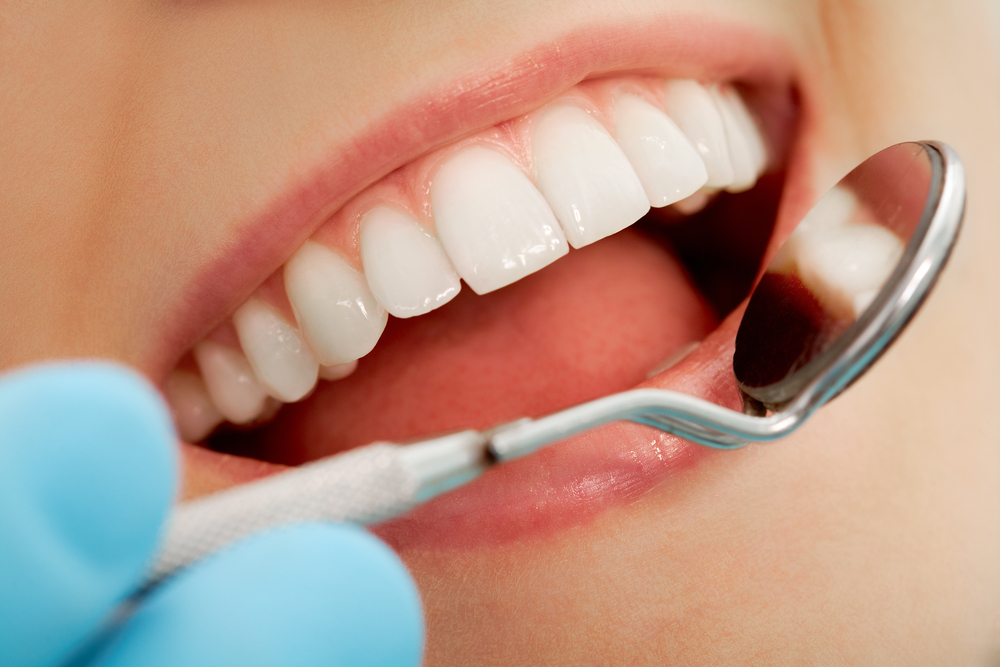 虫歯・歯周病の予防｜Lips and Teeth Clinic 牛込歯科