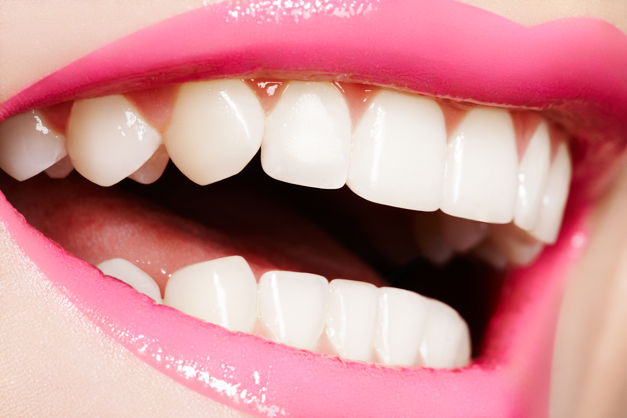 トランセント|Lips and Teeth Clinic 牛込歯科