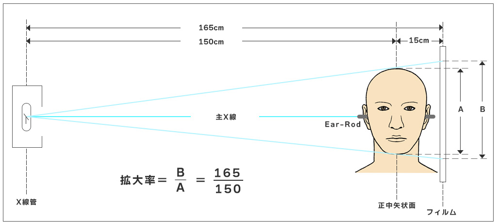 セファロ規格写真・矯正歯科